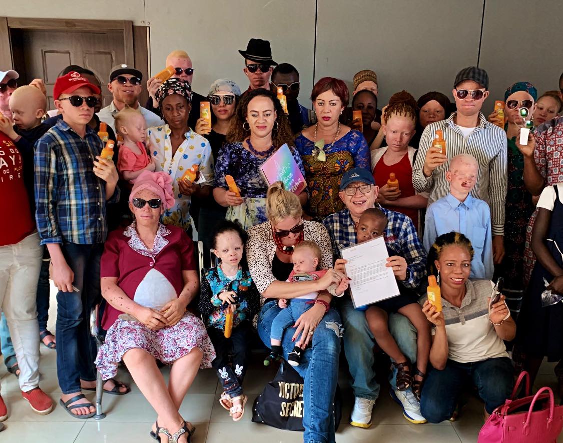 Children-with-albinism